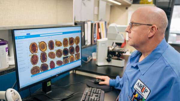 ARUP Laboratories Develops AI Tool for Rapid and Accurate Detection of Intestinal Parasites